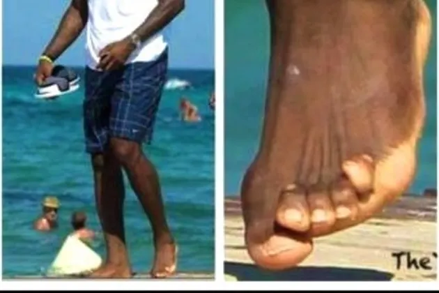 LeBron James toes
